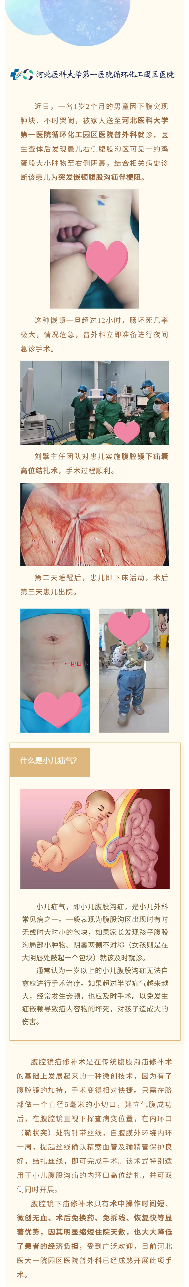 腹腔鏡微創(chuàng)手術(shù)治療小兒疝氣&mdash;&mdash;切口5毫米！手術(shù)&rarr;活動，僅半天！-1.jpg